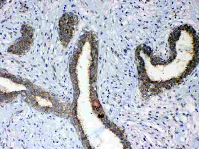 ERBB4 / HER4 Antibody - Immunohistochemistry - Anti-ErbB 4 Picoband antibody