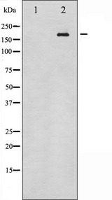 ERBB4 / HER4 Antibody - Western blot analysis of HER4 expression in whole cells lysates. The lane on the left is treated with the antigen-specific peptide.