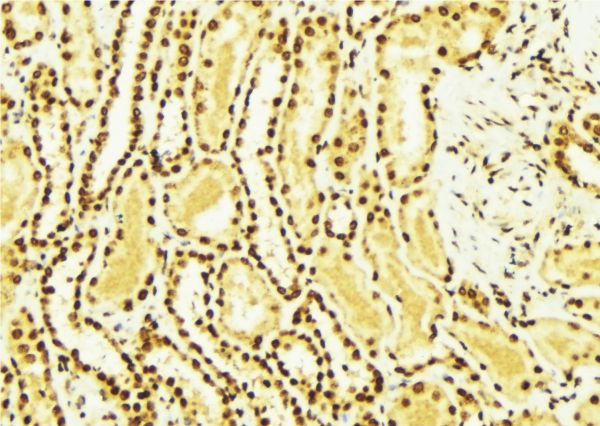 ERBB4 / HER4 Antibody - 1:100 staining mouse kidney tissue by IHC-P. The sample was formaldehyde fixed and a heat mediated antigen retrieval step in citrate buffer was performed. The sample was then blocked and incubated with the antibody for 1.5 hours at 22°C. An HRP conjugated goat anti-rabbit antibody was used as the secondary.