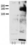 ERBB4 / HER4 Antibody - Phospho-HER4-Y1162 Antibody was used to detect Phospho-HER4-Y1162 in FG pancreatic carcinoma cell line lysate. FG pancreatic carcinoma cells treated with or without EGF (50ng/ml) for 15 min Phospho-HER4-Y1162 Antibody was used at 1:750 in 3% BSA. Data and protocol kindly provided by Dr. Weis of Cheresh Lab, UCSD.