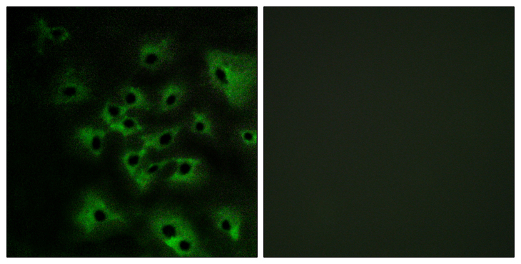 ERBB4 / HER4 Antibody - Immunofluorescence analysis of HeLa cells treated with EGF 200nM 5', using HER4 (Phospho-Tyr1284) Antibody. The picture on the right is blocked with the phospho peptide.