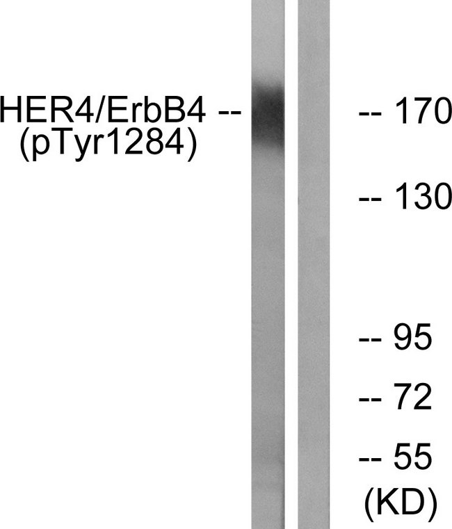 ERBB4 / HER4 Antibody - Western blot analysis of lysates from HUVEC cells treated with EGF 200ng/ml 30', using HER4 (Phospho-Tyr1284) Antibody. The lane on the right is blocked with the phospho peptide.