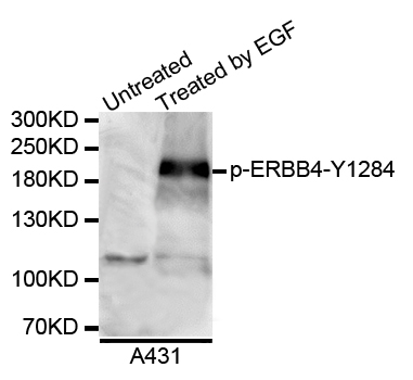 ERBB4 / HER4 Antibody - Western blot analysis of extracts of A431 cells.