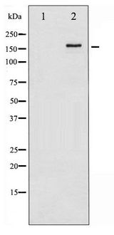 ERBB4 / HER4 Antibody - Western blot of HER4 phosphorylation expression in EGF treated HUVEC whole cell lysates,The lane on the left is treated with the antigen-specific peptide.