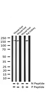 ERBB4 / HER4 Antibody - Western blot analysis of Phospho-HER4 (Tyr1284) expression in various lysates