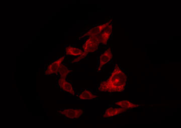ERBB4 / HER4 Antibody - Staining HuvEc cells by IF/ICC. The samples were fixed with PFA and permeabilized in 0.1% Triton X-100, then blocked in 10% serum for 45 min at 25°C. The primary antibody was diluted at 1:200 and incubated with the sample for 1 hour at 37°C. An Alexa Fluor 594 conjugated goat anti-rabbit IgG (H+L) Ab, diluted at 1/600, was used as the secondary antibody.