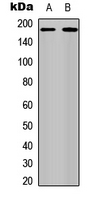 ERBB4 / HER4 Antibody - Western blot analysis of HER4 (pY1284) expression in MCF7 (A); A431 EGF-treated (B) whole cell lysates.