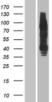 ERBB4 / HER4 Protein - Western validation with an anti-DDK antibody * L: Control HEK293 lysate R: Over-expression lysate