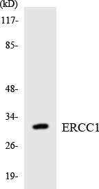 ERCC1 Antibody - Western blot analysis of the lysates from HeLa cells using ERCC1 antibody.