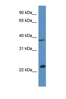ERCC1 Antibody - ERCC1 antibody Western blot of Mouse Liver lysate. Antibody concentration 1 ug/ml.  This image was taken for the unconjugated form of this product. Other forms have not been tested.