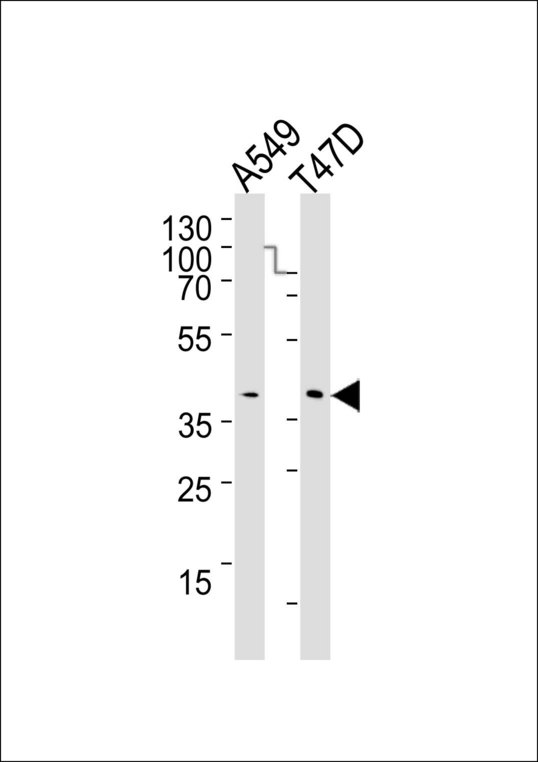 ERCC1 Antibody - Western blot of lysates from A549, T47D cell line (from left to right), using ERCC1 Antibody. Antibody was diluted at 1:1000 at each lane. A goat anti-mouse IgG H&L (HRP) at 1:3000 dilution was used as the secondary antibody. Lysates at 20ug per lane.
