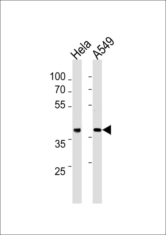 ERCC1 Antibody - ERCC1 Antibody western blot of HeLa,A549 cell line lysates (35 ug/lane). The ERCC1 antibody detected the ERCC1 protein (arrow).