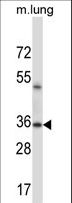ERCC1 Antibody - ERCC1 Antibody western blot of mouse lung tissue lysates (35 ug/lane). The ERCC1 antibody detected the ERCC1 protein (arrow).
