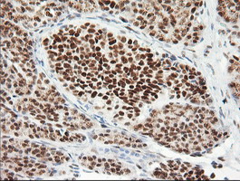 ERCC1 Antibody - Immunohistochemical staining of paraffin-embedded Human pancreas tissue using anti-ERCC1 mouse monoclonal antibody. (Clone 2E12, dilution 1:100; heat-induced epitope retrieval by 10mM citric buffer, pH6.0, 120C for 3min)