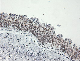 ERCC1 Antibody - Immunohistochemical staining of paraffin-embedded Human bladder tissue using anti-ERCC1 mouse monoclonal antibody. (Clone 2E12, dilution 1:100; heat-induced epitope retrieval by 10mM citric buffer, pH6.0, 120C for 3min)