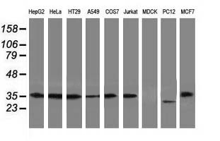 ERCC1 Antibody - Western blot analysis of extracts. (35ug) from 9 different cell lines by using anti-ERCC1 monoclonal antibody. (Clone 2E12).