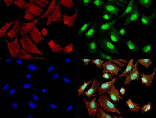 ERCC1 Antibody - Immunofluorescent staining of HeLa cells using ERCC1 mouse monoclonal antibody  green). Actin filaments were labeled with TRITC-phalloidin. (red), and nuclear with DAPI. (blue). The three-color overlay image is located at the bottom-right corner.