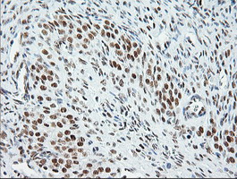 ERCC1 Antibody - Immunohistochemical staining of paraffin-embedded Human Ovary tissue using anti-ERCC1 mouse monoclonal antibody. (Clone 2E12, dilution 1:100; heat-induced epitope retrieval by 10mM citric buffer, pH6.0, 120C for 3min)
