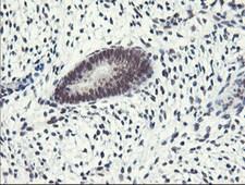 ERCC1 Antibody - Immunohistochemical staining of paraffin-embedded Human endometrium tissue using anti-ERCC1 mouse monoclonal antibody. (Clone 2E12, dilution 1:100; heat-induced epitope retrieval by 10mM citric buffer, pH6.0, 120C for 3min)