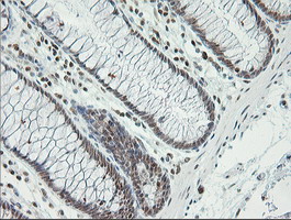 ERCC1 Antibody - Immunohistochemical staining of paraffin-embedded Human colon tissue using anti-ERCC1 mouse monoclonal antibody. (Clone 2E12, dilution 1:100; heat-induced epitope retrieval by 10mM citric buffer, pH6.0, 120C for 3min)