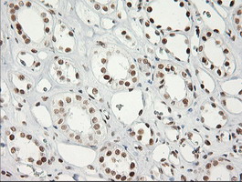 ERCC1 Antibody - Immunohistochemical staining of paraffin-embedded Human Kidney tissue using anti-ERCC1 mouse monoclonal antibody. (Clone 2E12, dilution 1:100; heat-induced epitope retrieval by 10mM citric buffer, pH6.0, 120C for 3min)