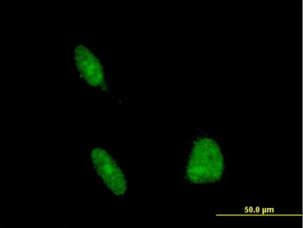 ERCC1 Antibody - Immunofluorescence of monoclonal antibody to ERCC1 on HeLa cell . [antibody concentration 10 ug/ml]