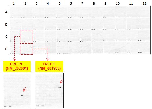 ERCC1 Antibody - OriGene overexpression protein microarray chip was immunostained with UltraMAB anti-ERCC1 mouse monoclonal antibody. (Clone 4F9). The positive reactive proteins are highlighted with red arrows in the enlarged subarray. Other positive controls spotted in this subarray are serial dilutions of mouse IgG as controls.