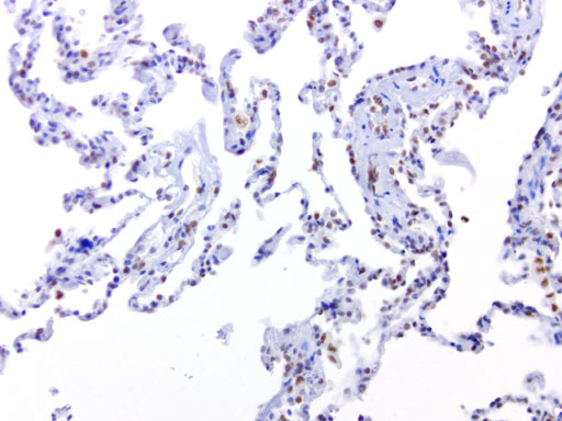ERCC1 Antibody - Immunohistochemical staining of FFPE normal adjacent lung from tumor specimen using heat-induced epitope retrieval HIER at 120C for 3min with Accel buffer pH8.7, mouse monoclonal antibody anti-ERCC1 clone 4F9 was used at 1ug/mL. Strong nuclear stain in lung pneumocytes and macrophages.