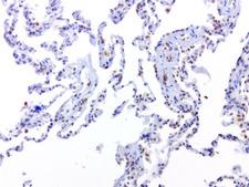 ERCC1 Antibody - Immunohistochemical staining of FFPE normal adjacent lung from tumor specimen using heat-induced epitope retrieval HIER at 120C for 3min with Accel buffer pH8.7, mouse monoclonal antibody anti-ERCC1 clone 4F9 was used at 1ug/mL. Strong nuclear stain in lung pneumocytes and macrophages.