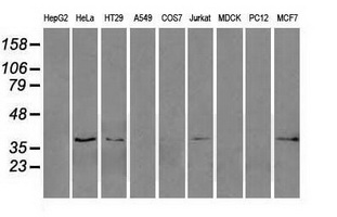 ERCC1 Antibody - Western blot analysis of extracts. (35ug) from 9 different cell lines by using anti-ERCC1 monoclonal antibody. (Clone 4F9).