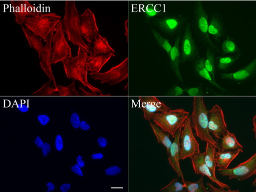 ERCC1 Antibody - Immunofluorescent staining of HeLa cells using anti-ERCC1 mouse monoclonal antibody  green, 1:100). Actin filaments were labeled with Alexa Fluor® 594 Phalloidin. (red), and nuclear with DAPI. (blue). Scale bar, 20µm.