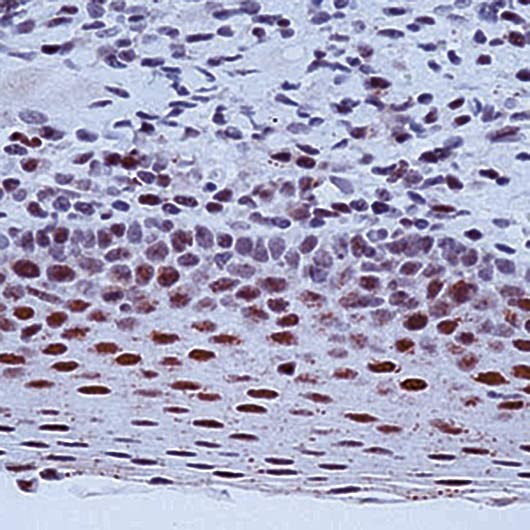 ERCC1 Antibody - Formalin-fixed, paraffin-embedded human tonsil stained with ERCC1 antibody.