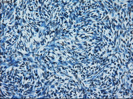 ERCC1 Antibody - Immunohistochemical staining of paraffin-embedded Ovary tissue using anti-ERCC1 mouse monoclonal antibody. (Dilution 1:50).