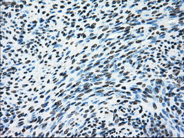ERCC1 Antibody - Immunohistochemical staining of paraffin-embedded endometrium tissue using anti-ERCC1 mouse monoclonal antibody. (Dilution 1:50).