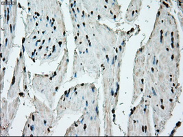 ERCC1 Antibody - Immunohistochemical staining of paraffin-embedded bladder tissue using anti-ERCC1 mouse monoclonal antibody. (Dilution 1:50).