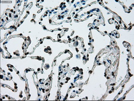 ERCC1 Antibody - Immunohistochemical staining of paraffin-embedded lung tissue using anti-ERCC1 mouse monoclonal antibody. (Dilution 1:50).