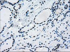 ERCC1 Antibody - Immunohistochemical staining of paraffin-embedded thyroid tissue using anti-ERCC1 mouse monoclonal antibody. (Dilution 1:50).