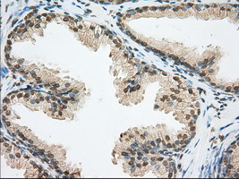 ERCC1 Antibody - Immunohistochemical staining of paraffin-embedded prostate tissue using anti-ERCC1 mouse monoclonal antibody. (Dilution 1:50).