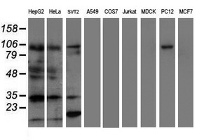 ERCC1 Antibody - Western blot of extracts (35ug) from 9 different cell lines by using anti-ERCC1 monoclonal antibody (HepG2: human; HeLa: human; SVT2: mouse; A549: human; COS7: monkey; Jurkat: human; MDCK: canine; PC12: rat; MCF7: human).