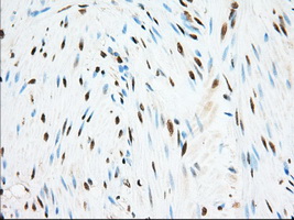 ERCC1 Antibody - Immunohistochemical staining of paraffin-embedded Human colon tissue using anti-ERCC1 mouse monoclonal antibody. (Dilution 1:50).