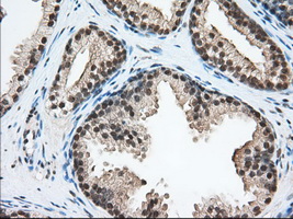 ERCC1 Antibody - Immunohistochemical staining of paraffin-embedded Human prostate tissue using anti-ERCC1 mouse monoclonal antibody. (Dilution 1:50).