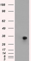 ERCC1 Antibody - HEK293T cells were transfected with the pCMV6-ENTRY control (Left lane) or pCMV6-ENTRY ERCC1 (Right lane) cDNA for 48 hrs and lysed. Equivalent amounts of cell lysates (5 ug per lane) were separated by SDS-PAGE and immunoblotted with anti-ERCC1.