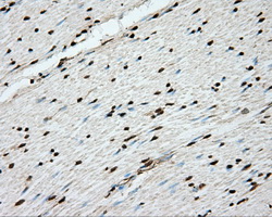 ERCC1 Antibody - Immunohistochemical staining of paraffin-embedded colon tissue using anti-ERCC1 mouse monoclonal antibody. (Dilution 1:50).