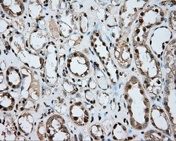 ERCC1 Antibody - Immunohistochemical staining of paraffin-embedded Kidney tissue using anti-ERCC1 mouse monoclonal antibody. (Dilution 1:50).