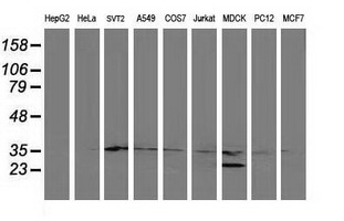 ERCC1 Antibody - Western blot of extracts (35ug) from 9 different cell lines by using anti-ERCC1 monoclonal antibody.