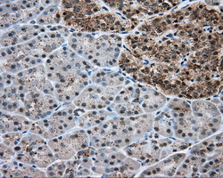 ERCC1 Antibody - Immunohistochemical staining of paraffin-embedded pancreas tissue using anti-ERCC1 mouse monoclonal antibody. (Dilution 1:50).