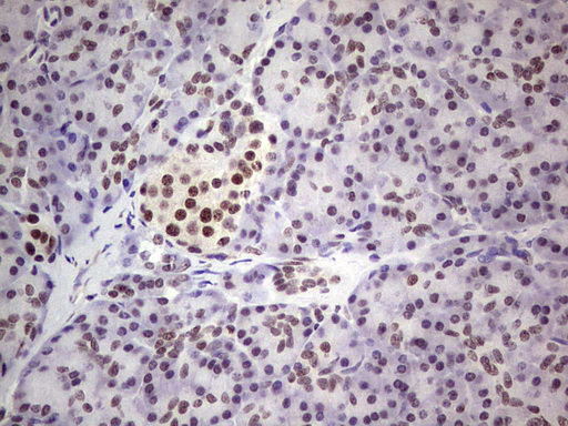 ERCC1 Antibody - Immunohistochemical staining of paraffin-embedded Human pancreas tissue within the normal limits using anti-ERCC1 mouse monoclonal antibody. (Heat-induced epitope retrieval by 1 mM EDTA in 10mM Tris, pH8.5, 120C for 3min,