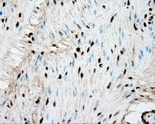ERCC1 Antibody - Immunohistochemical staining of paraffin-embedded colon tissue using anti-ERCC1 mouse monoclonal antibody. (Dilution 1:50).