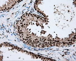 ERCC1 Antibody - Immunohistochemical staining of paraffin-embedded prostate tissue using anti-ERCC1 mouse monoclonal antibody. (Dilution 1:50).