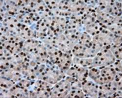 ERCC1 Antibody - Immunohistochemical staining of paraffin-embedded pancreas tissue using anti-ERCC1 mouse monoclonal antibody. (Dilution 1:50).